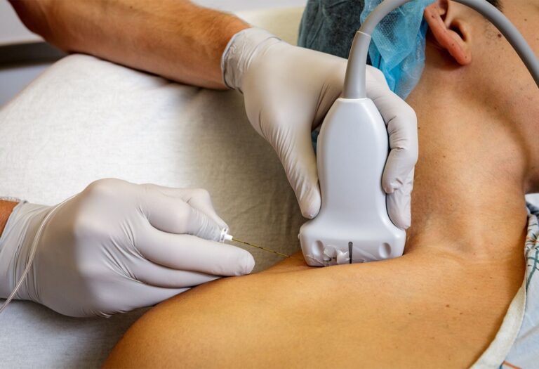 5 Questions to Ask Your Doctor about Nerve Blocks