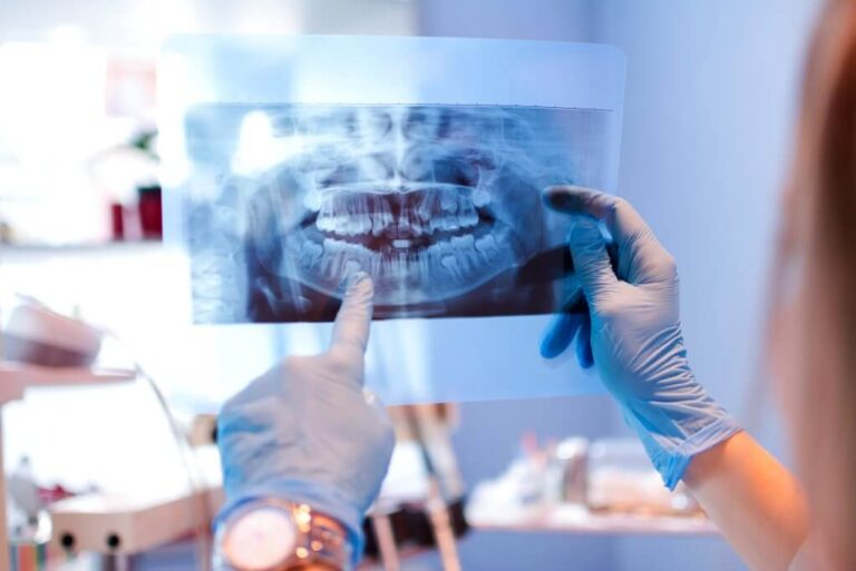 What are Digital X-Rays Used for in Dentistry?