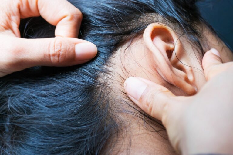 Comprehensive Lice Treatment in Louisville: Trusted Care for Lice Infestations
