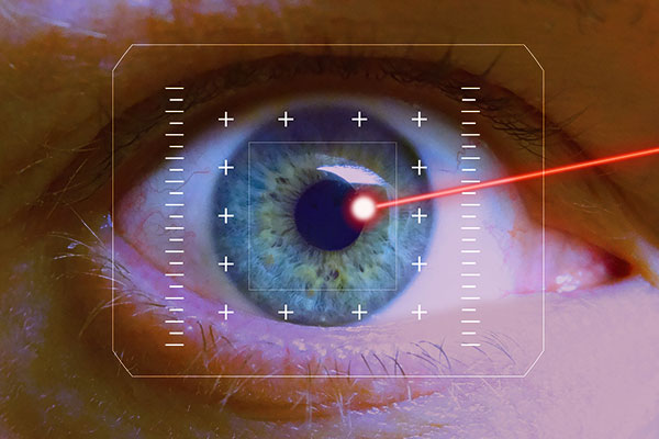 Laser Eye Surgery